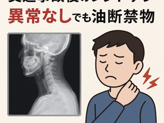 交通事故後のレントゲンで異常なしでも油断禁物/江東区北砂