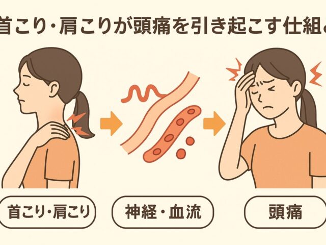 首こり・肩こりが頭痛を引き起こす仕組み｜原因と改善法/江東区北砂