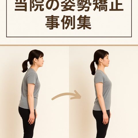 【ビフォーアフター写真あり】当院の姿勢矯正事例集/江東区北砂