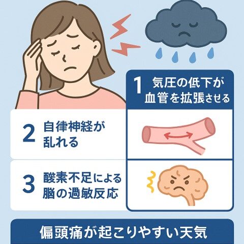 偏頭痛と天気の関係｜気圧変化で頭痛が起こる理由/江東区北砂