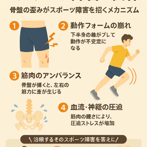 🏃‍♂️ 骨盤の歪みとスポーツ障害の関係/江東区北砂